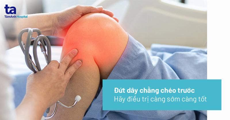 Hình ảnh phim chụp MRI khớp gối cho thấy dây chằng chéo trước bị đứt, phục vụ chẩn đoán chính xác đứt dây chằng chéo trước